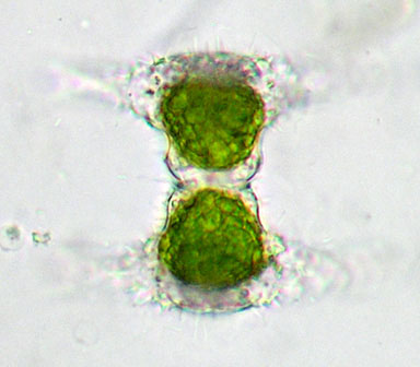 Staurastrum manfeldtii